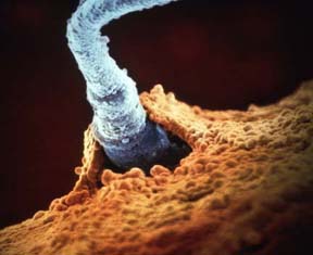 Fertilization between a sperm cell and an egg cell