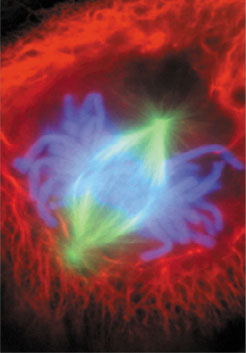 Cell Division - Notice the mitotic spindle as well as the condensed chromosomes. Which phase of mitosis are you looking at?